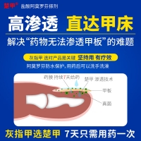 盐酸阿莫罗芬搽剂(楚甲)